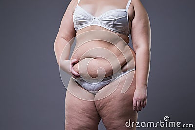 Woman with fat abdomen, overweight female stomach Stock Photo