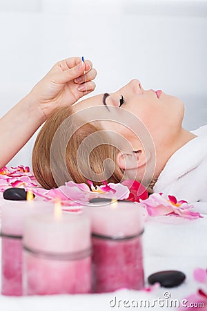 Woman Getting Acupuncture Treatment Stock Photo