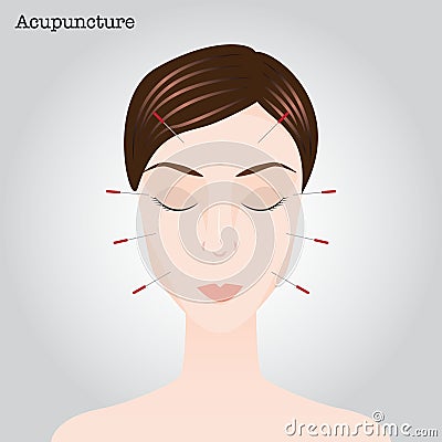 Woman getting an acupuncture treatment Cartoon Illustration