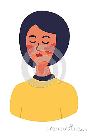 Woman or girl with Rash on the face. Pimples or Acne. Dermatology. Allergy. Cartoon vector illustration isolated on white Cartoon Illustration