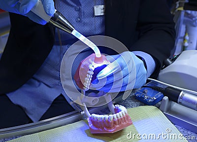 Woman hands in blue gloves shining on the plastic moulage of human jaws and teeth - typodont - with the photopolymer lamp Stock Photo