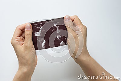 Woman hands holding picture of ultrasound of embryo on white background Stock Photo