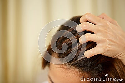 A woman has problems with hair and scalp,she has dandruff from allergic reactions to shampoos. Stock Photo