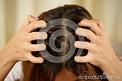 A woman has problems with hair and scalp,she has dandruff from allergic reactions to shampoos. Stock Photo