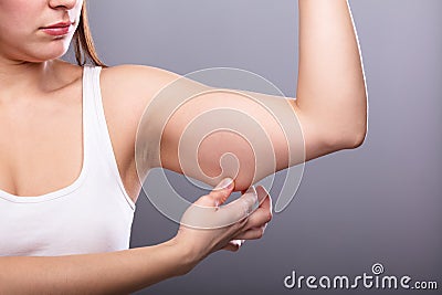 Woman Holding Arm With Excess Fat Stock Photo