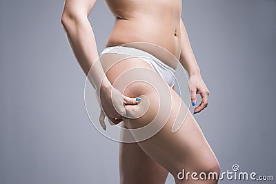 Woman holding fold of skin, cellulite on female body, gray background Stock Photo