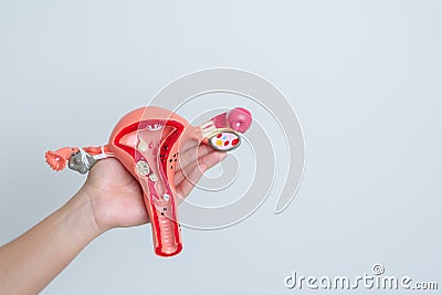 Woman holding Uterus and Ovaries model. Ovarian and Cervical cancer, Cervix disorder, Endometriosis, Hysterectomy, Uterine Stock Photo