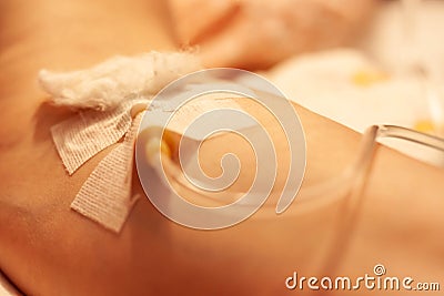 A woman with an illness is being treated at home due to a lack of hospital beds. Dropper with a needle and medicine Stock Photo