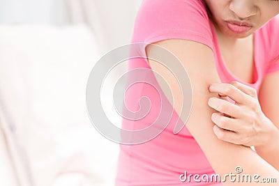 Woman with itchy skin Stock Photo