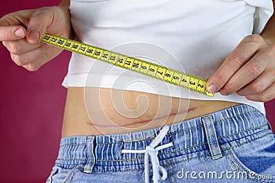 Woman measures scar of caesarean section with tape measure Stock Photo