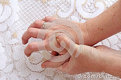 A woman with Parkinson`s disease has her hands shaking Stock Photo