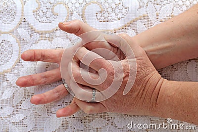 A woman with Parkinson`s disease has her hands shaking Stock Photo