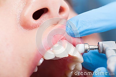 Woman patient brushed teeth in close-up in dental office Stock Photo