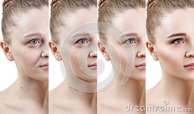 Woman with phase of skin rejuvenation before and after treatment. Stock Photo