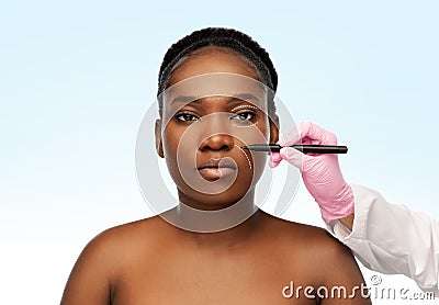 Woman and plastic surgeon`s hand with marker Stock Photo