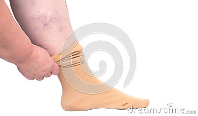 Woman putting on the leg medical stocking for varicose veins on the legs, white background, isolate, close-up, phlebeurysm Stock Photo