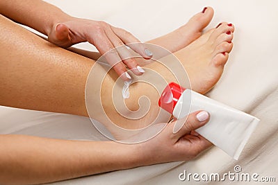 Woman putting ointment on bad ankle applying cream Stock Photo