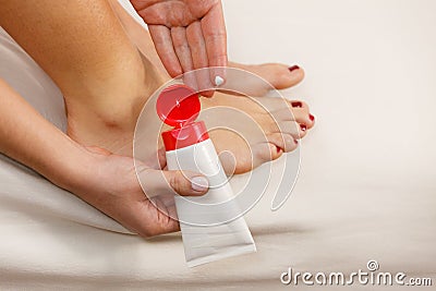 Woman putting ointment on bad ankle applying cream Stock Photo