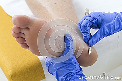 Woman receiving podiatry treatment- podiatrist chiropodist cleaning womans feet Stock Photo