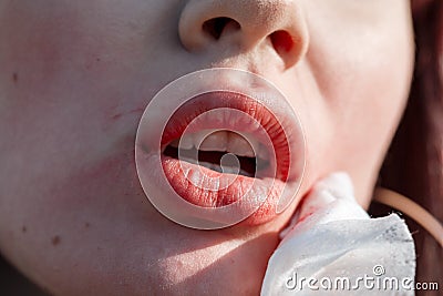 Woman removes lipstick from lips outdoors Stock Photo