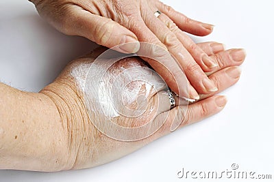 A woman rubs her hands with an ointment of pain Stock Photo