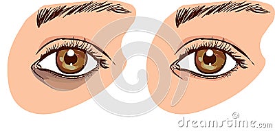 The woman`s face with dark circles under the eyes. The concept o Vector Illustration