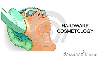 The woman`s face during machine cosmetology Vector Illustration