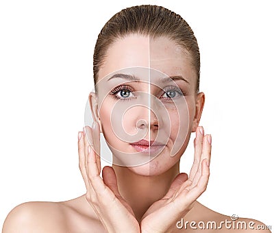 Woman`s face before and after rejuvenation. Stock Photo