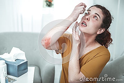Woman with scratch marks on her elbow using eye drops Stock Photo