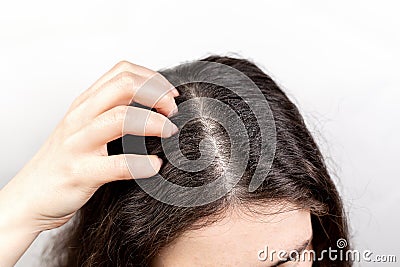 The woman scratches her head with her hand, showing a parting of dark hair with dandruff. Close up. The view from the top. White Stock Photo