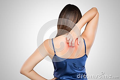 Woman scratching her itchy back with allergy rash Stock Photo