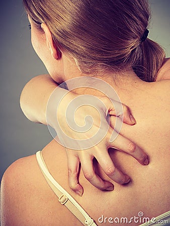 Woman scratching her itchy back with allergy rash Stock Photo