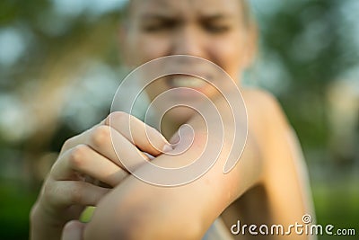 A woman scratching her itchy mosquito bite. Tropical climate danger Stock Photo