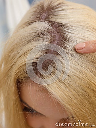 Woman showing blonde hair roots Stock Photo