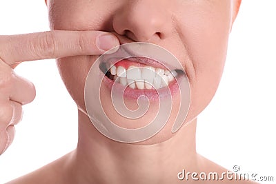 Woman showing inflamed gums on white background, closeup view Stock Photo