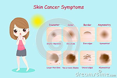 Woman with skin cancer symptoms Vector Illustration
