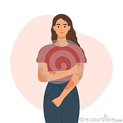 Woman with skin disease concept. Skin rash, psoriasis, dermatitis or eczema flat style vector illustration Vector Illustration