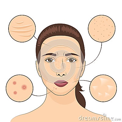 Woman skin problem vector illustration. Female face with skins problematic areas Vector Illustration