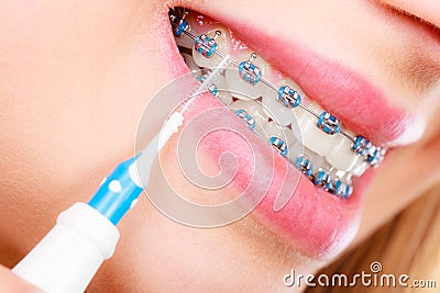 Woman smiling cleaning teeth with braces Stock Photo