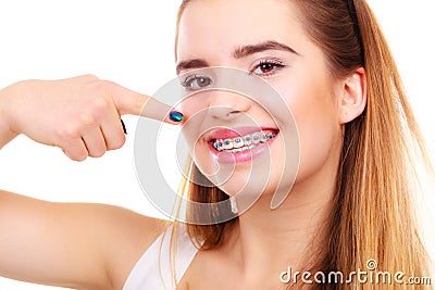 Woman smiling showing teeth with braces Stock Photo