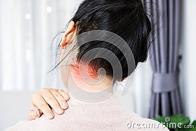 Woman suffering from neck back, occipital pain Stock Photo
