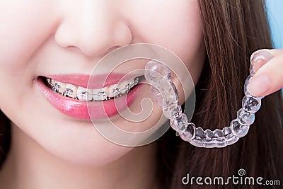 Woman take invisible braces Stock Photo