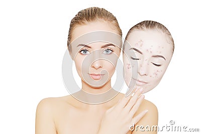 Woman takes away mask with acne and pimples,grey background Stock Photo