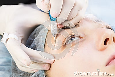 Medical micro needle therapy with a modern medical instrument derma roller. Stock Photo