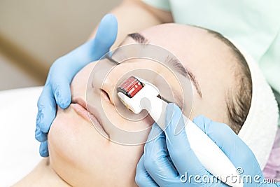 Procedure of medical micro needle therapy with a modern medical instrument derma roller Stock Photo