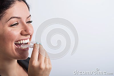 A woman uses transparent retainers to whiten teeth Stock Photo