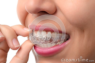 Woman wearing orthodontic silicone trainer Stock Photo