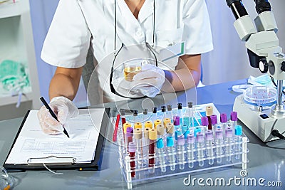 Woman wearing white coat holding a urine sample in his hand Stock Photo