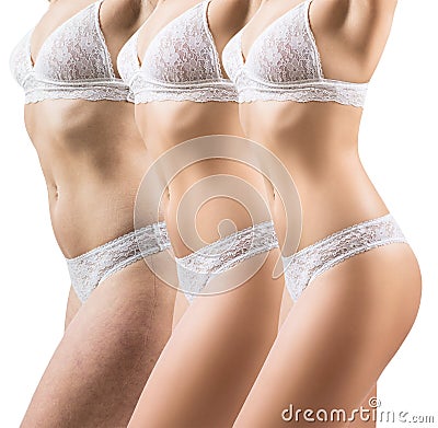 Woman before and after weight loss. Body slimming concept. Stock Photo