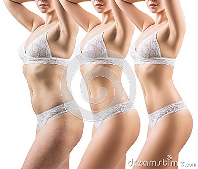 Woman before and after weight loss. Body slimming concept. Stock Photo